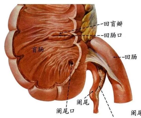 回盲部较多内容物
