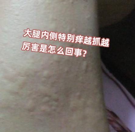手心和脚心突然特别痒