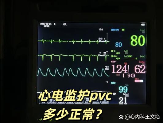 PVC心电监护图标
