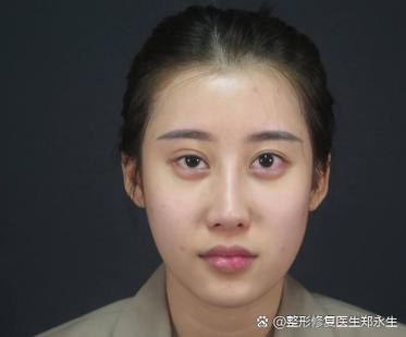 美图秀秀怎么调整大小眼