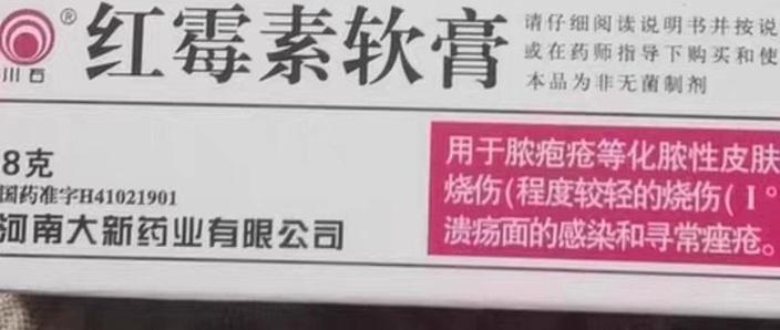 烫伤了用红霉素软膏行吗图标