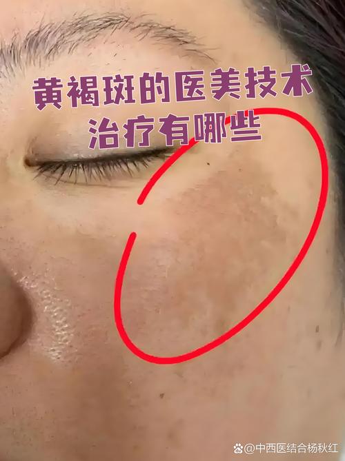 手机进水出现光斑图标