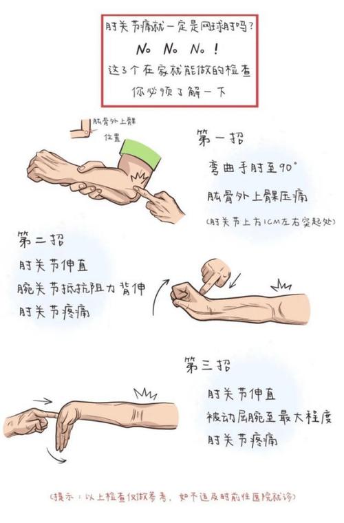 手肘疼痛位置图解缩略图