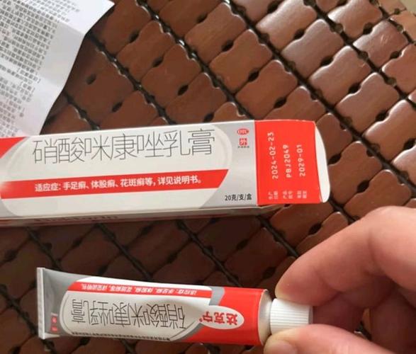 真菌感染用什么药膏