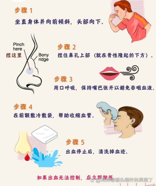 太干燥会不会流鼻血缩略图