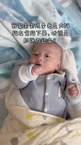 婴儿不正常握拳的图片
