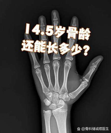男孩骨头粗会影响长高吗