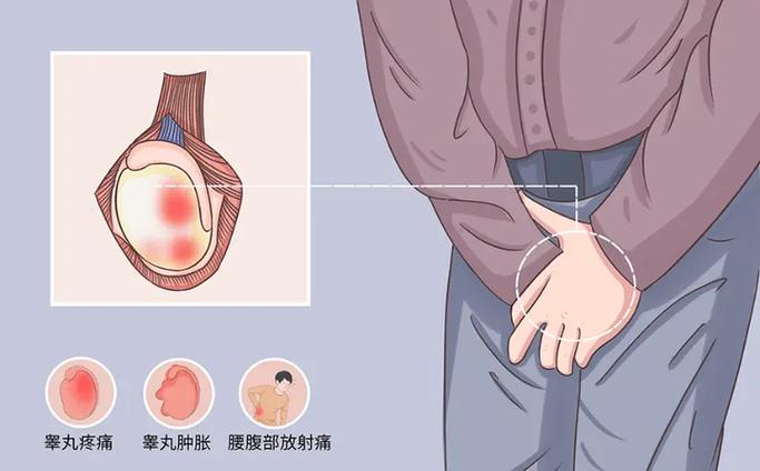 闲得蛋疼是什么意思?