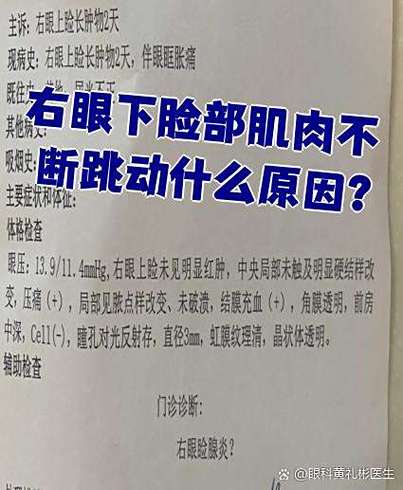 右眼下部肌肉跳啥原因