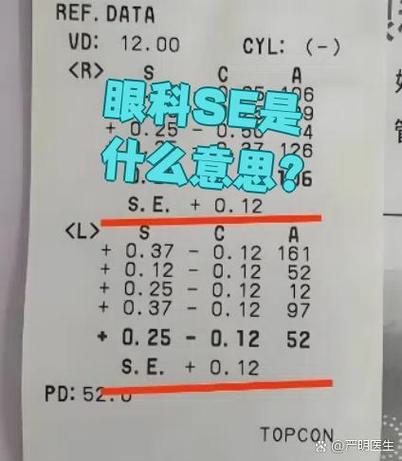 se指的是什么