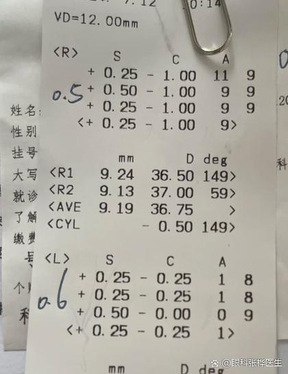 儿童散光100度严重吗