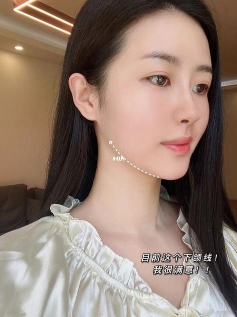 下巴肉松弛下垂怎么办图标