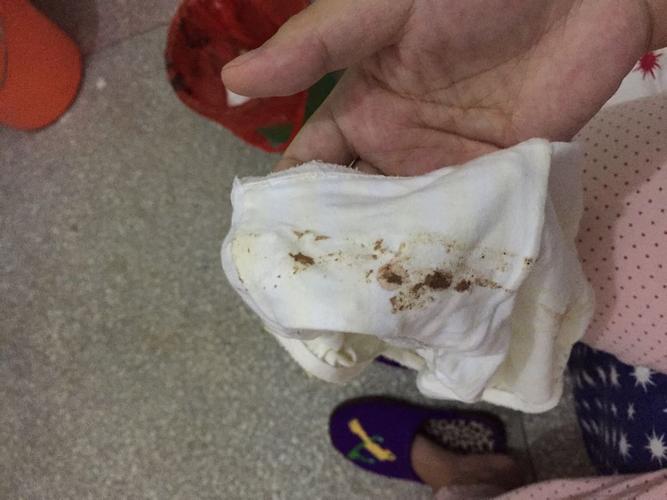 还没到例假期有褐色分泌物排出
