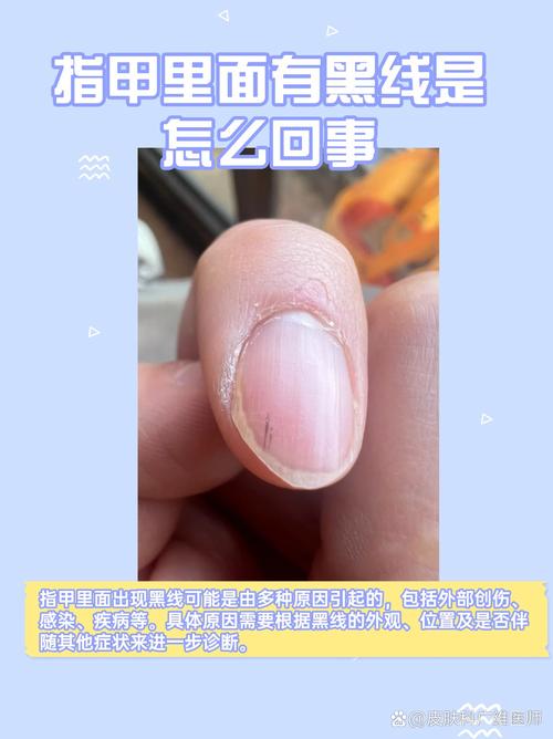 打印机黑线是什么情况