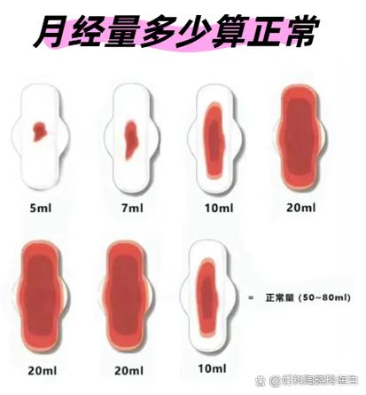 姨妈流量很少怎么回事