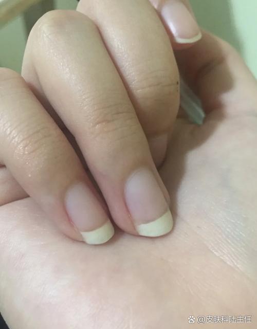 洗完澡指甲变透明截图