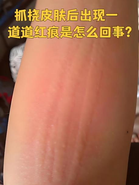 身上突然出现抓痕图标