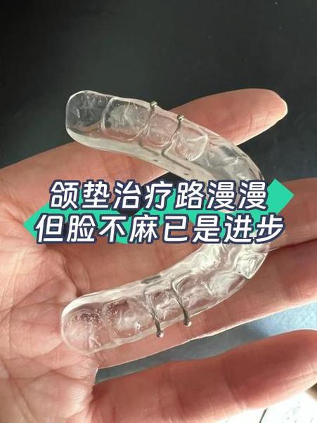 颌垫带多久咬合才能调整好截图