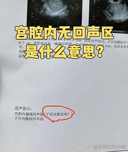房间有回声好还是无回声好