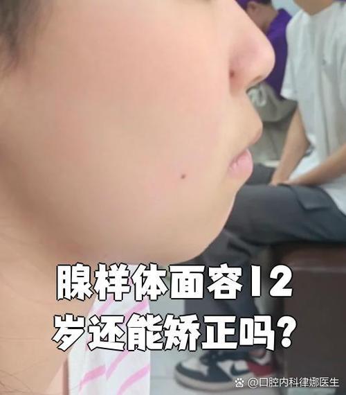 面容有问题可以修吗