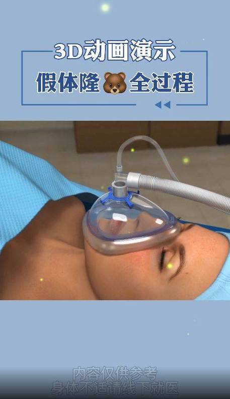 女生的胸长什么样子做手术视频