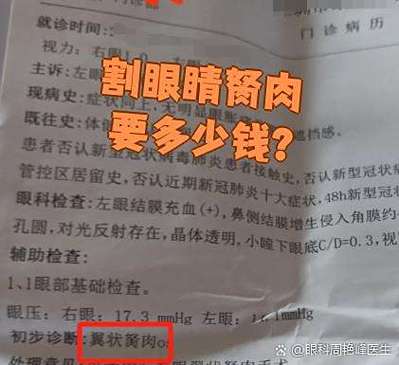 割眼睛胬肉要多少钱