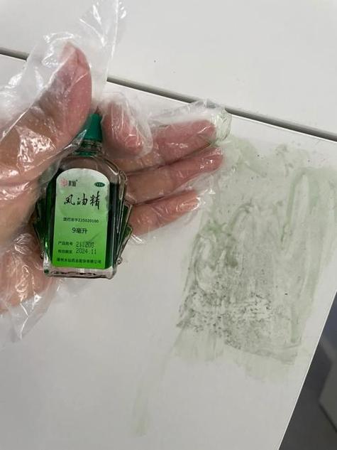 如何清除风油精的印迹