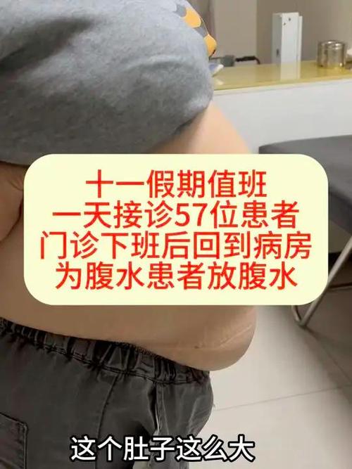 敲肚子有空响声是有腹水吗