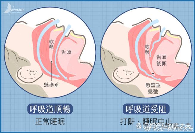 真人呼噜声mp3超大声