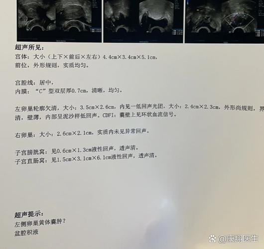 左侧卵巢内囊性暗区