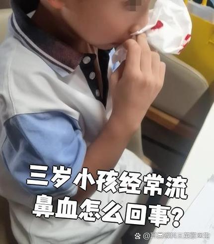 小孩不定时流鼻血是怎么回事