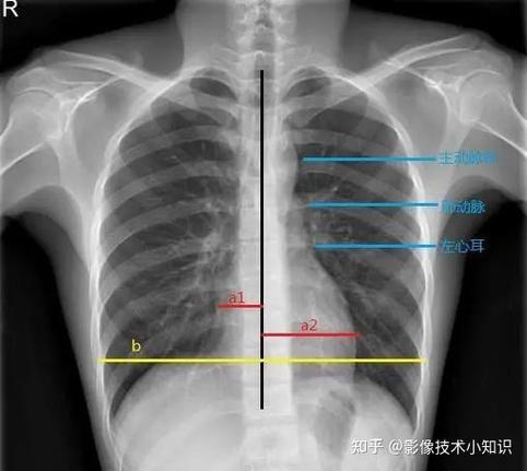 主人格和副人格的关系图标