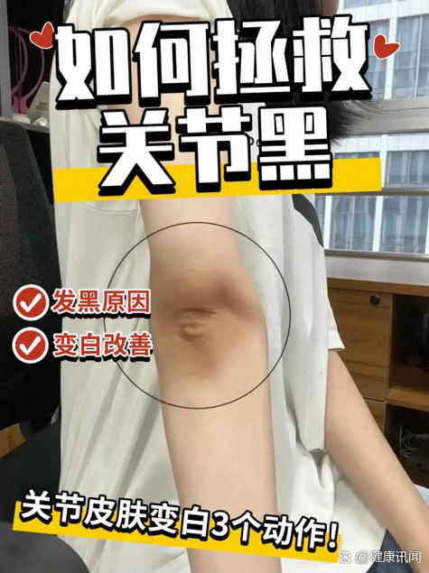 皮肤突然变黑了是什么原因