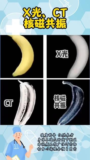 ct和x光的区别