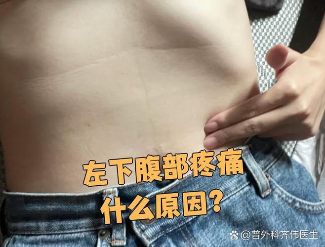 小腹部左下侧痛