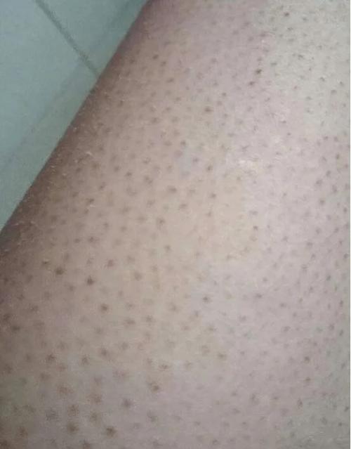 如何让鸡皮变黄