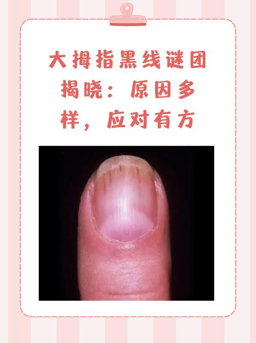 打开微信上面一条黑杠是什么意思图标