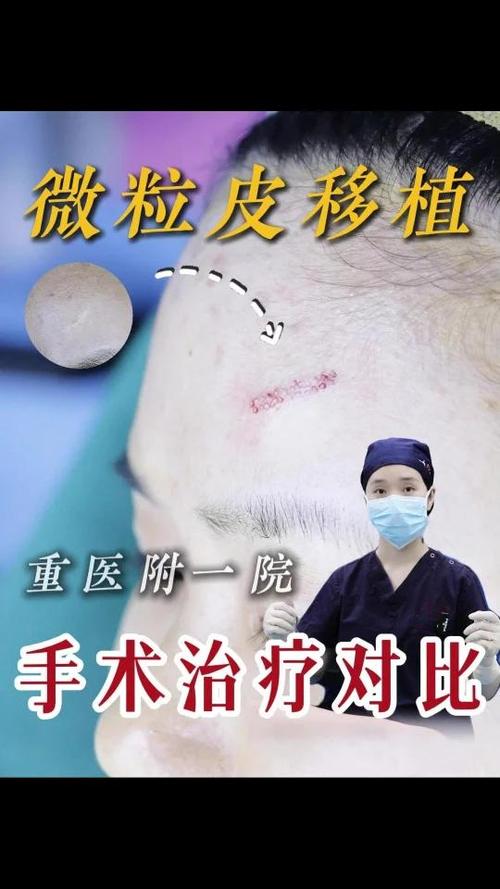 疤痕增生图片截图