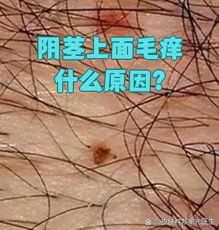 为什么小鸡老是痒