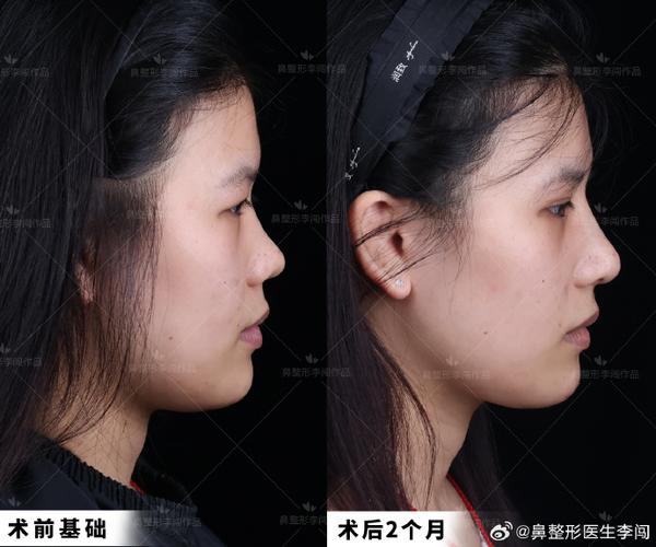 外推和内推什么区别截图