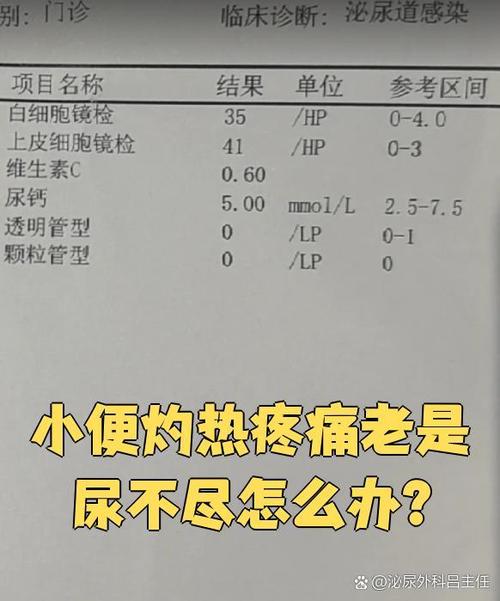 尿痛尿不干净有刺痛感