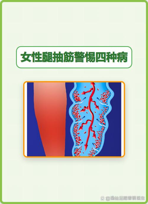 抽筋是什么意思缩略图