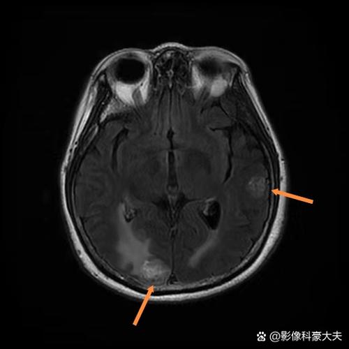 日本能承受几个沙皇核弹