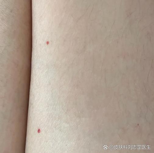 红点
