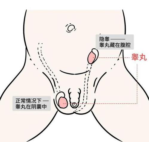 阴囊下垂好还是紧绷好