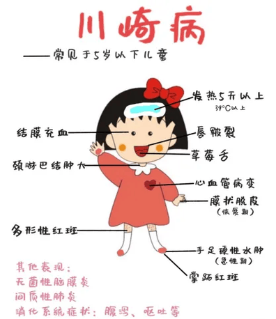 小孩得川崎病有什么症状游戏截图