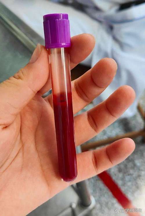 喝酒吹15化验血酒精含量多少图标