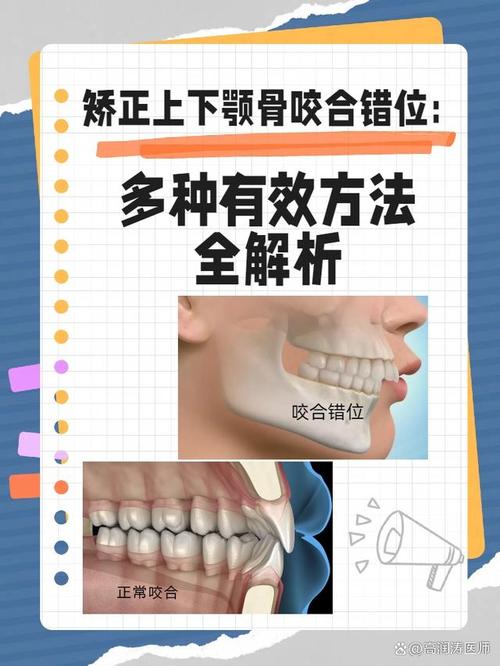 上下线不咬合怎么解决图标