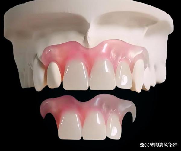 裤子破了个洞怎么缝看不出来