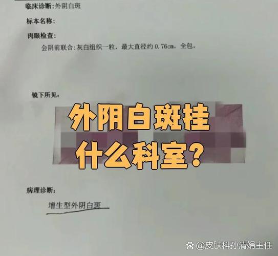 女性白斑去医院挂什么科